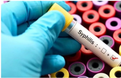 Mais de 6 mil casos de sífilis são registrados em Cuiabá em 10 anos, diz prefeitura